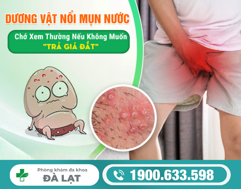 Hình ảnh minh họa